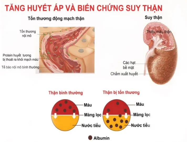 D:\BS BICH\nhung-nguyen-nhan-gay-benh-suy-than.jpg