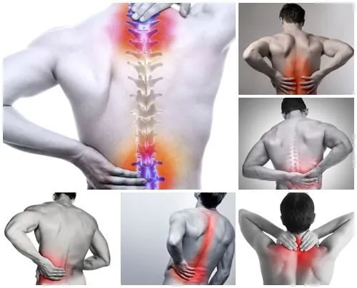 Điều trị thoái hóa cột sống có dễ không?