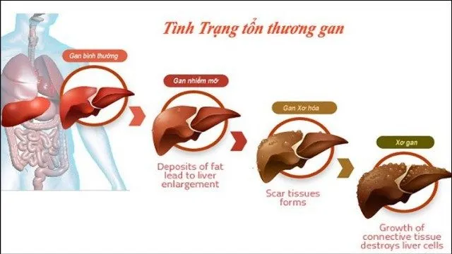 https://baodansinh.mediacdn.vn/Images/2019/05/07/ruou-bia-huy-hoai-gan-nhu-the-nao1557235270.jpg