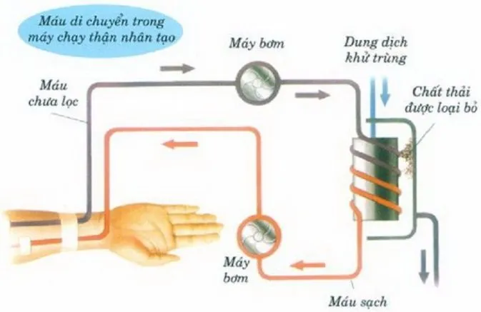 D:\BS BICH\HÌNH ẢNH\Máy-chạy-thận-nhân-tạo.jpg
