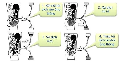 D:\BS BICH\HÌNH ẢNH\unnamed (1).jpg