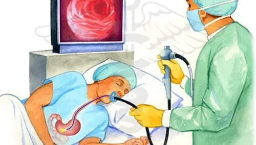 Hình ảnh nội soi dạ dày | TCI Hospital