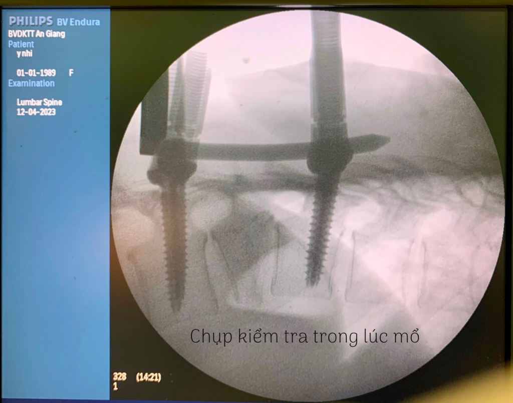 Bệnh Viện Đa Khoa An Giang