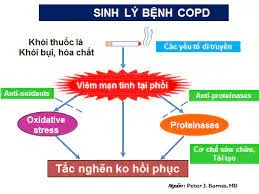 Bệnh phổi tắc nghẽn mãn tính - Bệnh Viện Đa Khoa Trung Tâm An Giang