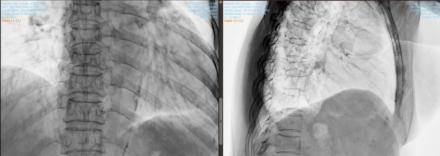 A close up of a chest x-ray
Description automatically generated