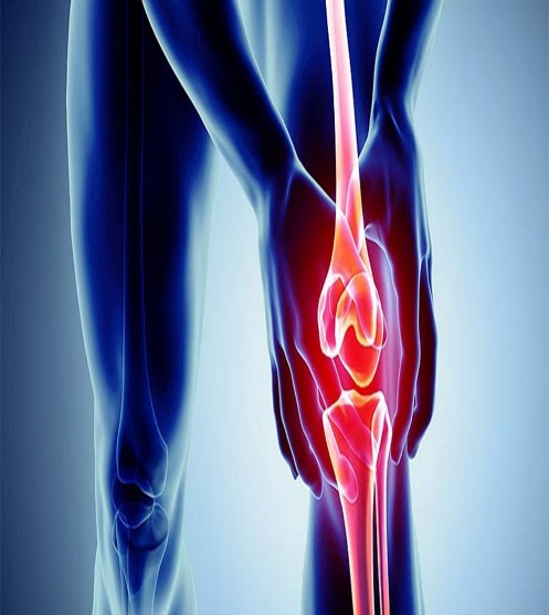 Thoái hóa khớp gối có triệu chứng đau, viêm