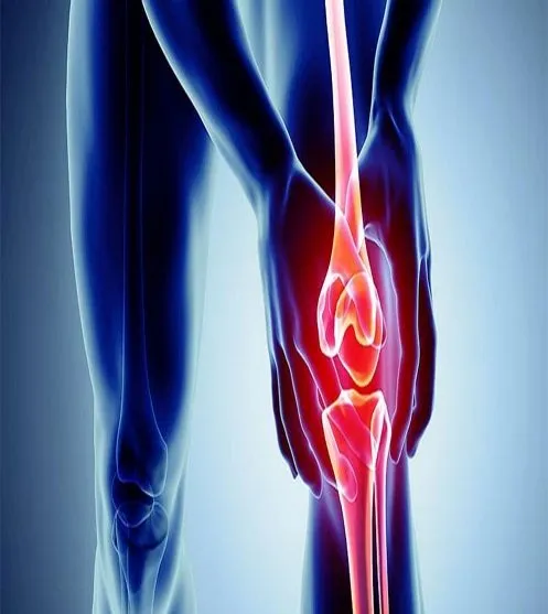 Thoái hóa khớp gối có triệu chứng đau, viêm