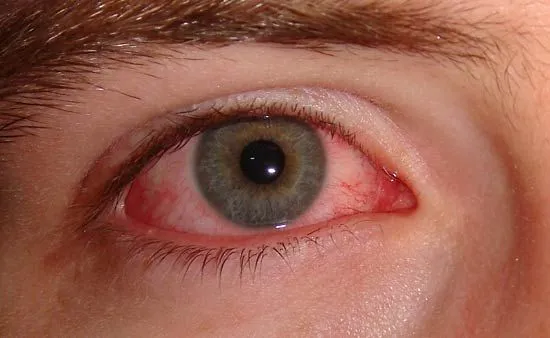 A close-up of a person's eye Description automatically generated